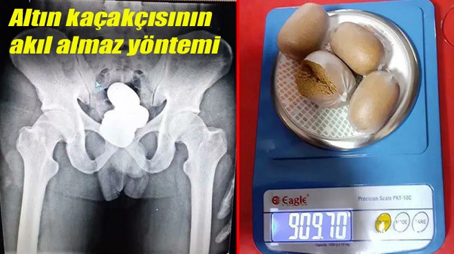 X-RAY CİHAZINDA YAKALANDI